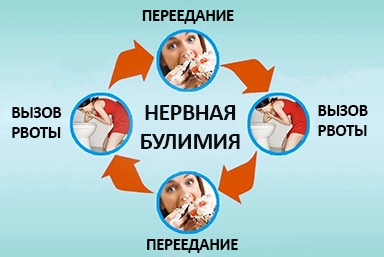 Лечение булимии в Благовещенск